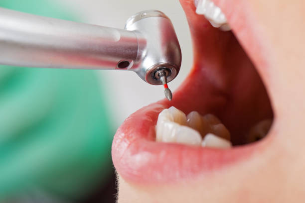Best Emergency Gum Treatment in Vineyard, UT
